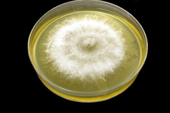 How to get rid of the mold for nails
