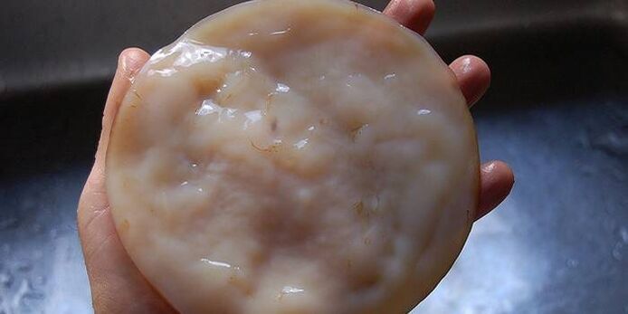 Kombucha against nail fungus